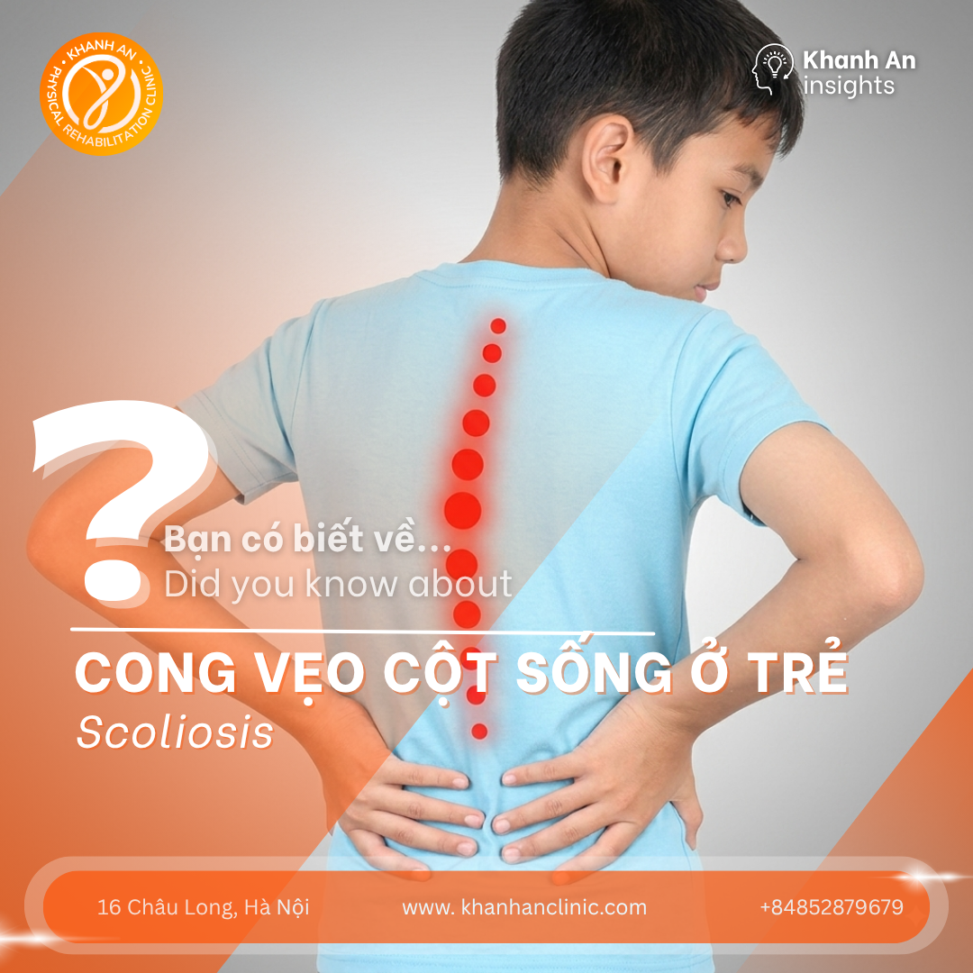 Vật lý trị liệu trong hỗ trợ điều trị cong vẹo cột sống ở trẻ