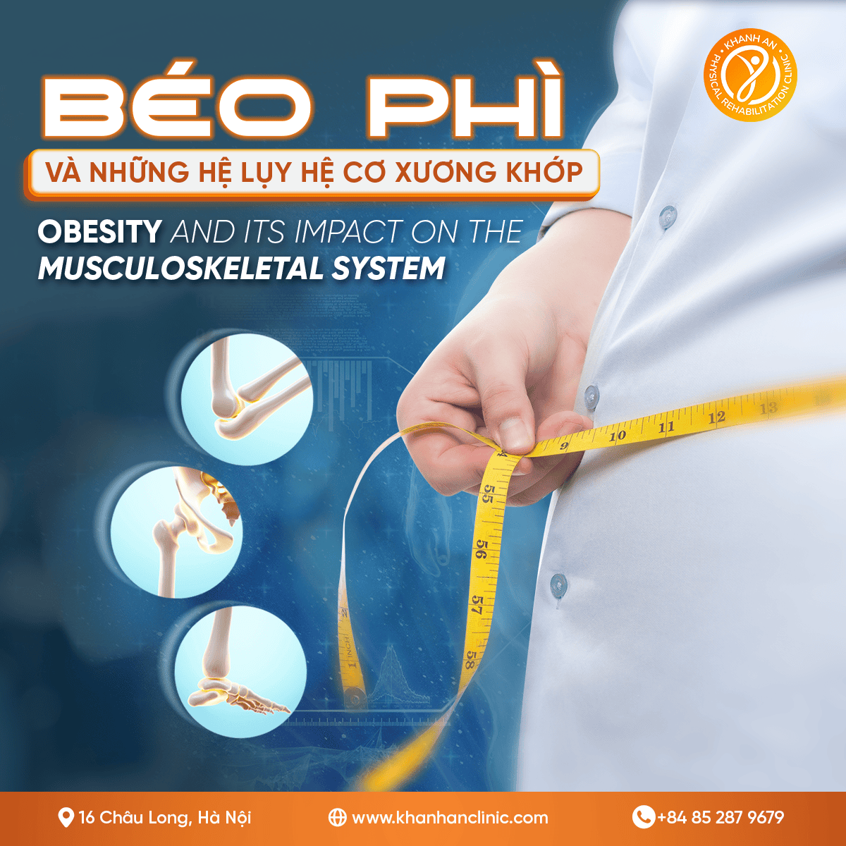 Béo Phì Và Những Hệ Lụy Đến Cơ Xương Khớp