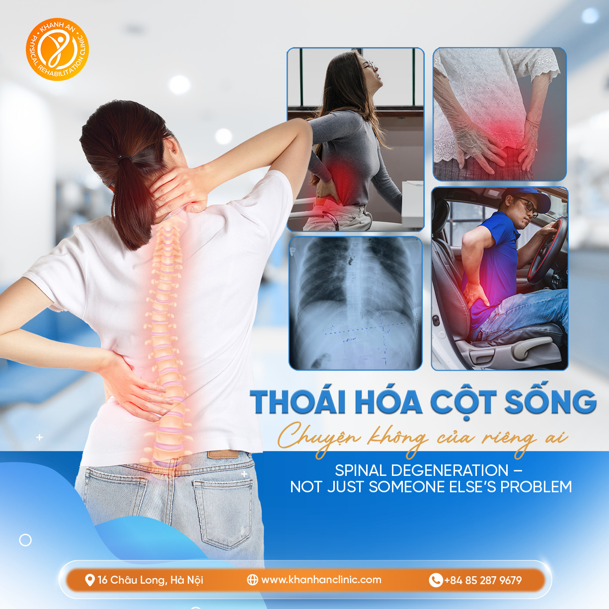 Cảnh Báo - Thoái hóa Đốt Sống đang ngày càng Trẻ hóa